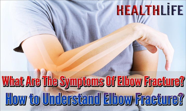 What Are The Symptoms Of Elbow Fracture