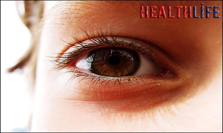 Can Stress Cause Pain Behind Left Eye