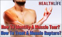 How To Identify A Muscle Tear
