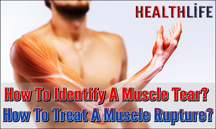 How To Identify A Muscle Tear