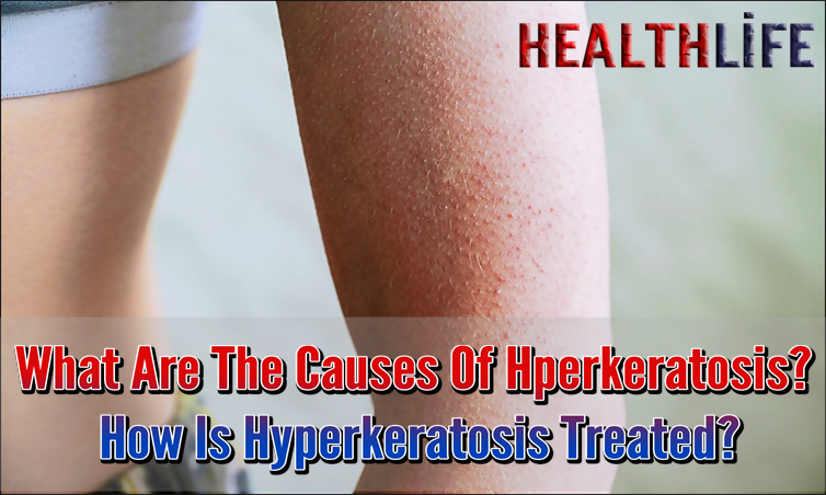What Are The Causes Of Hperkeratosis
