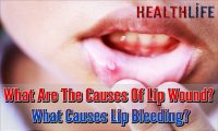 What Are The Causes Of Lip Wound