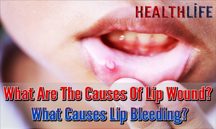 What Are The Causes Of Lip Wound