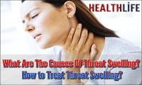 What Are The Causes Of Throat Swelling