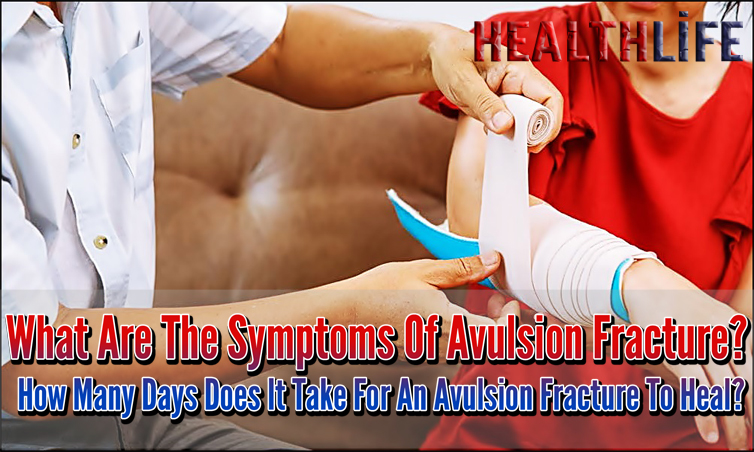 What Are The Symptoms Of Avulsion Fracture