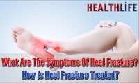 What Are The Symptoms Of Heel Fracture