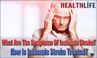 What Are The Symptoms Of Ischemic Stroke