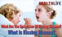 What Are The Symptoms Of Kissing Disease