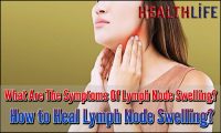 What Are The Symptoms Of Lymph Node Swelling