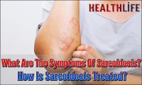 What Are The Symptoms Of Sarcoidosis