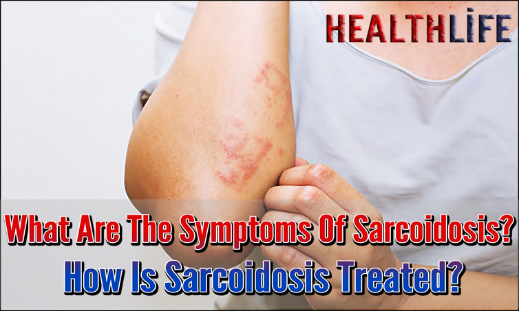 What Are The Symptoms Of Sarcoidosis