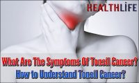 What Are The Symptoms Of Tonsil Cancer