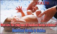 What Are The Symptoms Of Umbilical Hernia In Babies