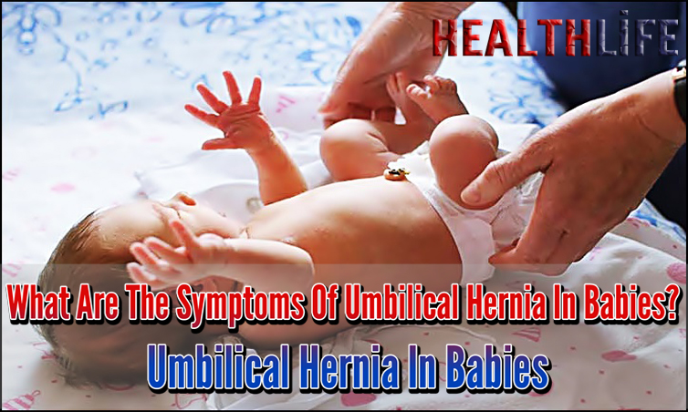 What Are The Symptoms Of Umbilical Hernia In Babies