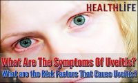 What Are The Symptoms Of Uveitis