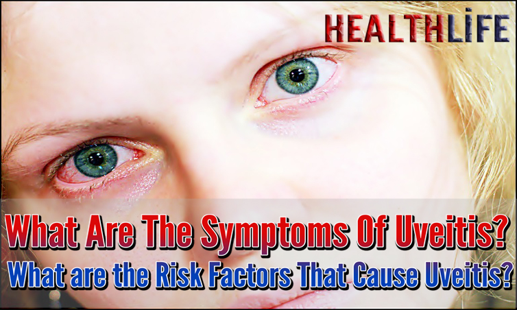What Are The Symptoms Of Uveitis