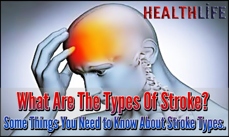What Are The Types Of Stroke