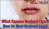 What Causes Bruised Lips
