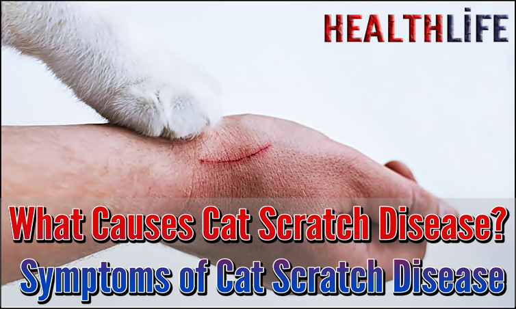 What Causes Cat Scratch Disease