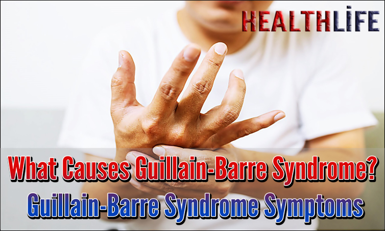 What Causes Guillain-Barre Syndrome