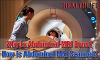 Why Is Abdominal MRI Done