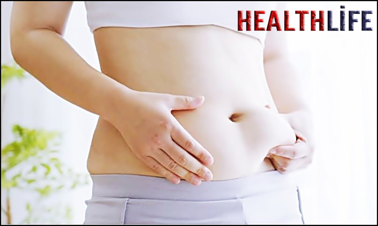 How Do I Stop My Stretch Marks