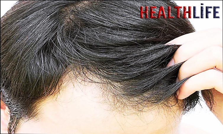 How Do You Take Care Of A Prosthetic Hair