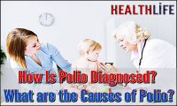 How Is Polio Diagnosed