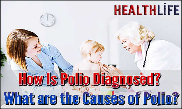 How Is Polio Diagnosed