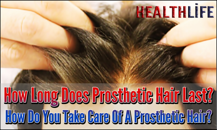 How Long Does Prosthetic Hair Last