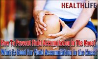 How To Prevent Fluid Accumulation In The Knee