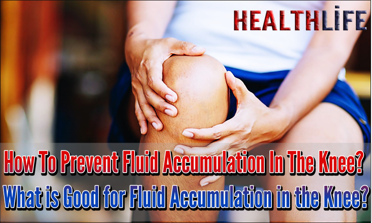 How To Prevent Fluid Accumulation In The Knee