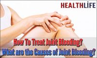 How To Treat Joint Bleeding