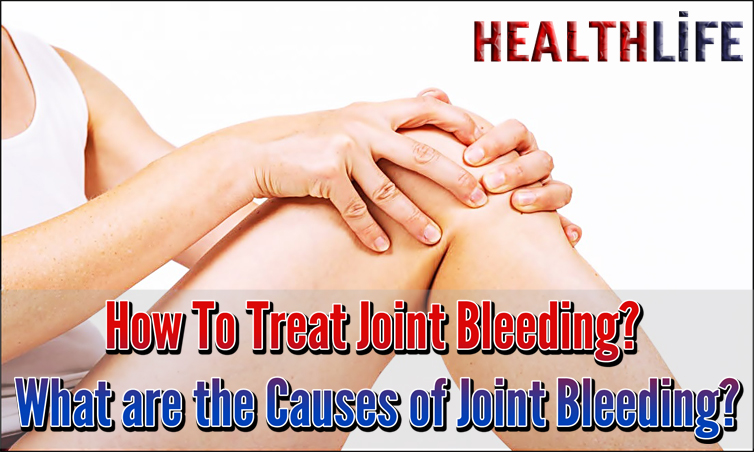 How To Treat Joint Bleeding