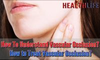 How To Understand Vascular Occlusion