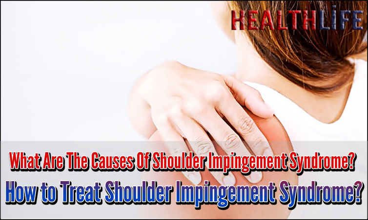 What Are The Causes Of Shoulder Impingement Syndrome