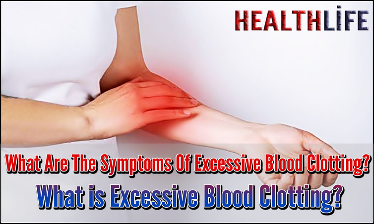 What Are The Symptoms Of Excessive Blood Clotting