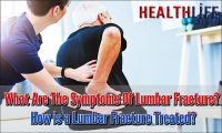 What Are The Symptoms Of Lumbar Fracture
