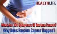 What Are The Symptoms Of Rectum Cancer