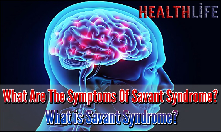 What Are The Symptoms Of Savant Syndrome