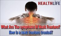 What Are The symptoms Of Neck Fracture
