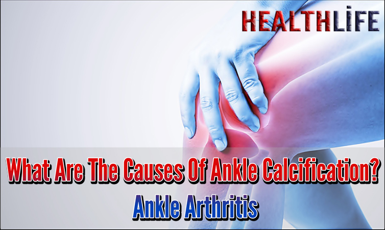 What Causes Calcification In The Ankle