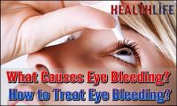 What Causes Eye Bleeding
