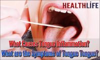 What Causes Tongue Inflammation