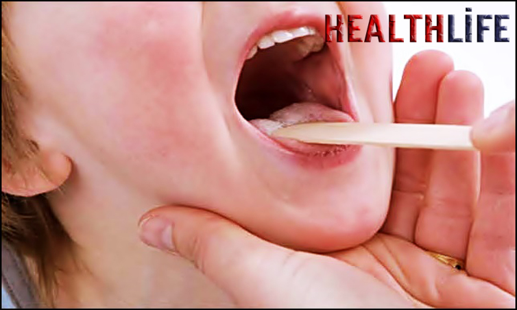 What Foods Cause Tongue Inflammation