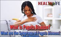 What Is Pagets Disease