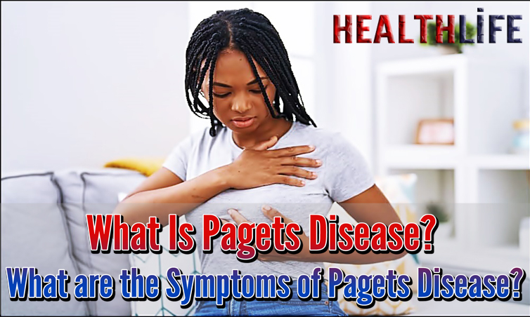 What Is Pagets Disease
