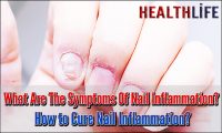 What Are The Symptoms Of Nail Inflammation