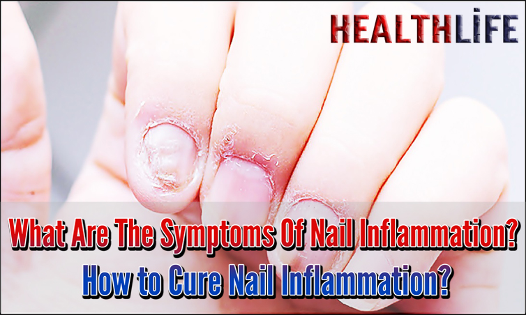 What Are The Symptoms Of Nail Inflammation