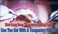 How Long Does Temporary Filling Last